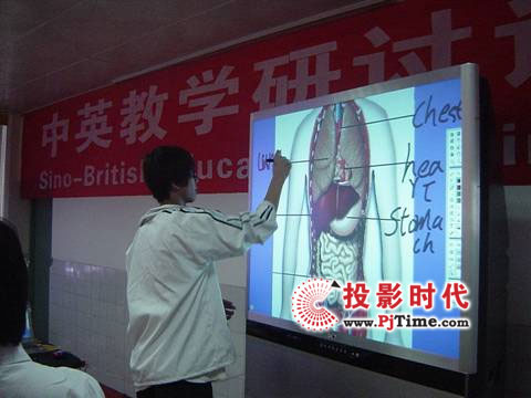 SCT����ʽ��(sh��)�ִ���Ļһ�w�C(j��)�����Ч�n��