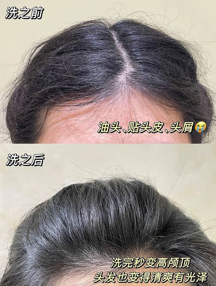 ȫ���m�õ�ȥм����ϴ�l(f��)ˮ�x�Ă���2026ȫ���g�οڱ�֮��������С���^�l(f��)���Ͷ����Ŀ��������